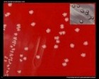 Corynebacterium pseudotuberculosis